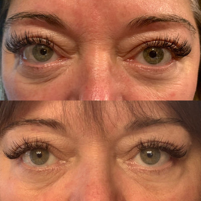 Eyebrations Triple Action Eye Serum Wins Coveted "Eye Cream of the Year" Award