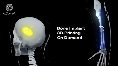 A.D.A.M., Developer of 3D-Bioprinting Platform, Launches Crowdfunding Campaign