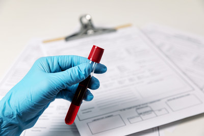 La FDA de los EE. UU. otorga la designación de dispositivo innovador a la prueba de sangre para detección de cáncer de mama en etapa temprana desarrollada por Datar Cancer Genetics