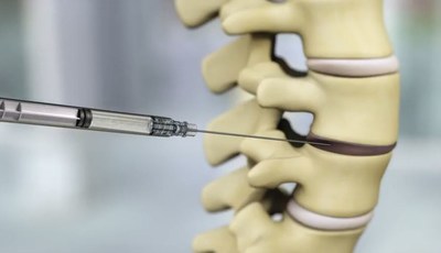 DiscGenics Announces Presentation of Positive Interim Clinical Data from Phase 1/2 Study of Cell Therapy for Degenerative Disc Disease