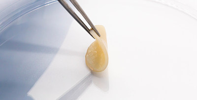 ALLOSOURCE'S CARTILAGE ALLOGRAFT EXPERTISE TO BE FEATURED AT THE INTERNATIONAL CARTILAGE REGENERATION & JOINT PRESERVATION SOCIETY ANNUAL MEETING