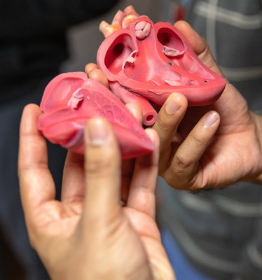 Innovative Medical 3D Printing at Tampa General Hospital and USF Health Morsani College of Medicine Provides Clearer Map for Surgery